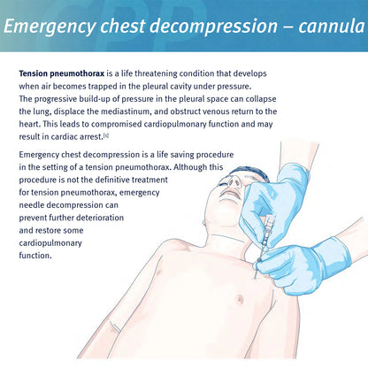 Rescue Pneumothorax Needle Trauma Medical Chest  Needle 50g Needle Decompression.